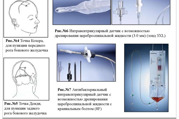 Где брать ссылки на кракен